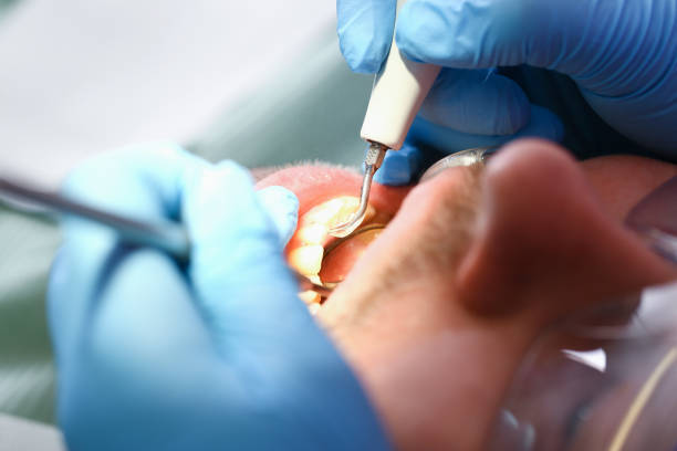 Best Holiday Emergency Dentist in Saline, MI