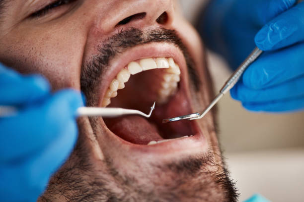 Best Emergency Dental Care for Abscessed Tooth in Saline, MI
